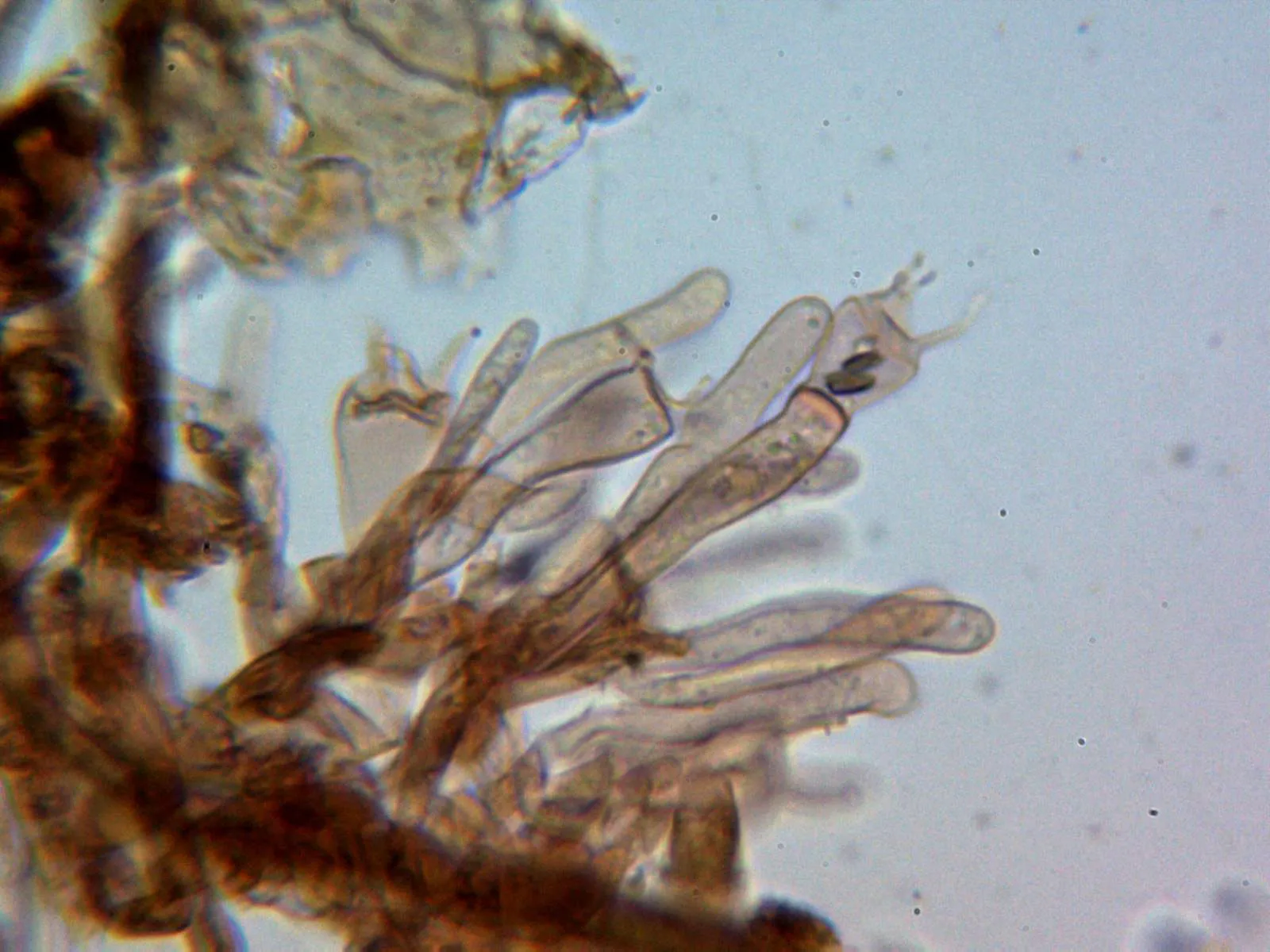 Microscopía de Tomentella badia - 10 - Basidios 1